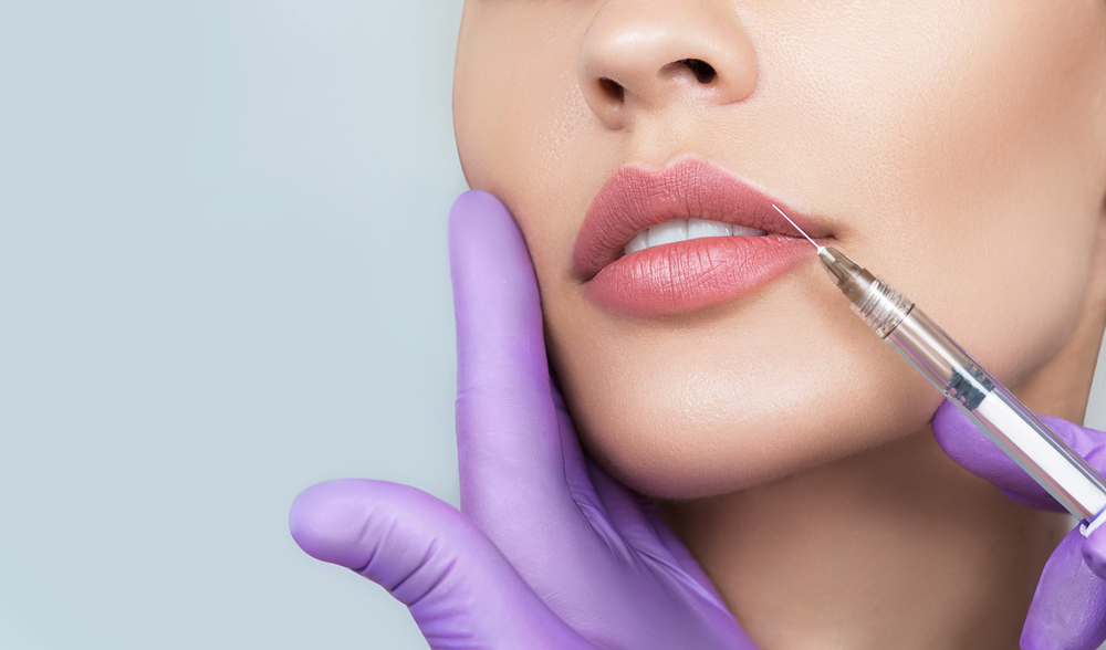 How Long Should Lip Fillers Last?