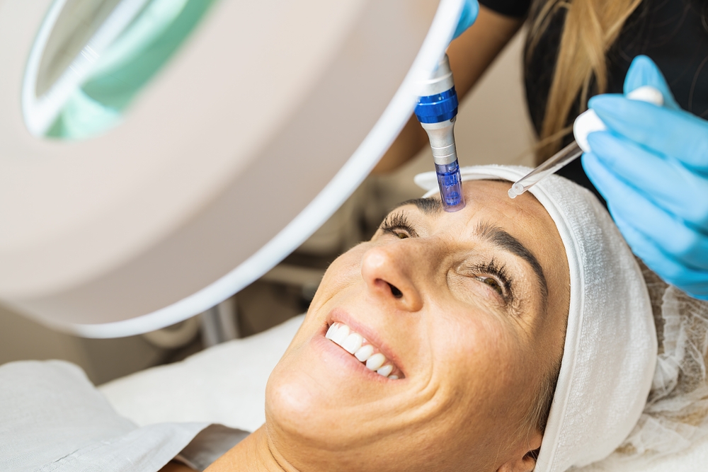 Long-Lasting PRP and Microneedling in Tysons Corner