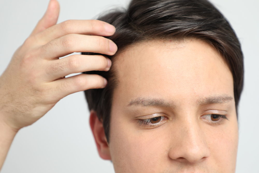 Alma TED Hair Restoration in Vienna