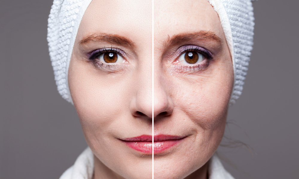 Best Non-Surgical Skin Tightening Results in Tysons Corner