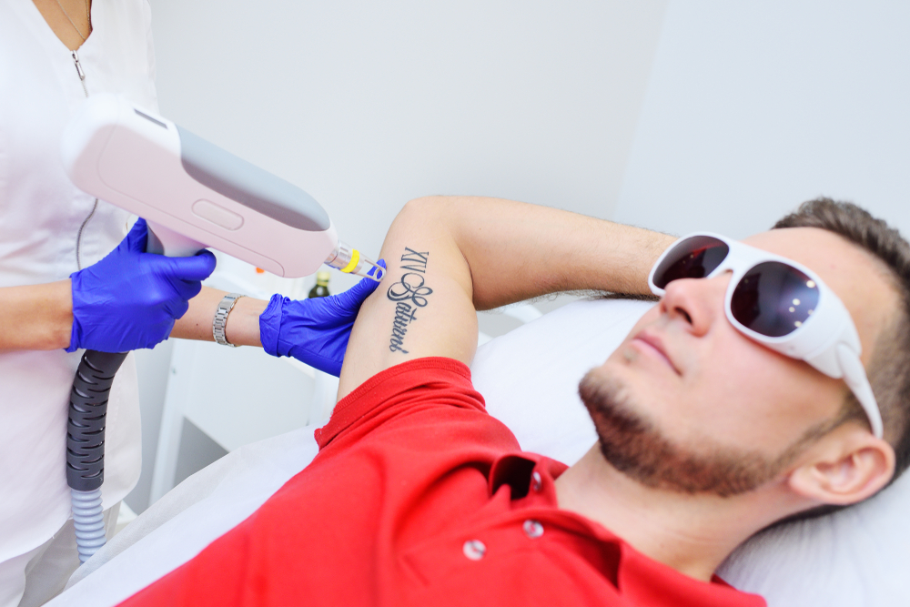 How to Find the Best Laser Tattoo Removal Clinic in Tysons Corner, VA