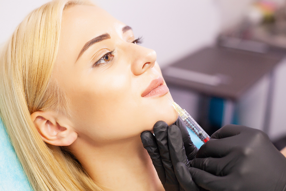 Lip Filler for Natural Volume in Tysons, VA