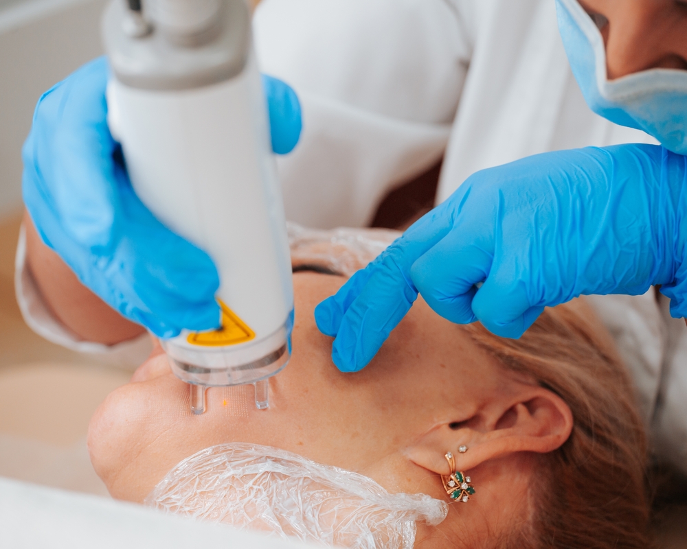 Find the Best Laser Resurfacing Specialist Near Falls Church VA