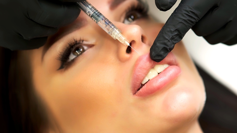Lip Filler Deals in Falls Church, VA: Best Pricing Options