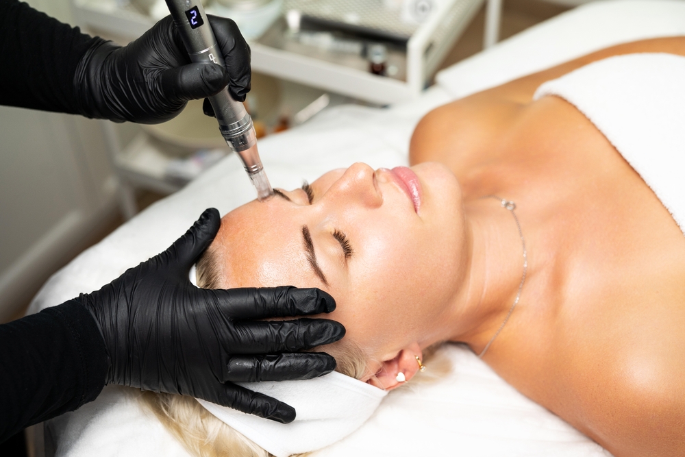 Best Skin Tightening and Microneedling Treatments in Vienna, VA for Natural Looking Results