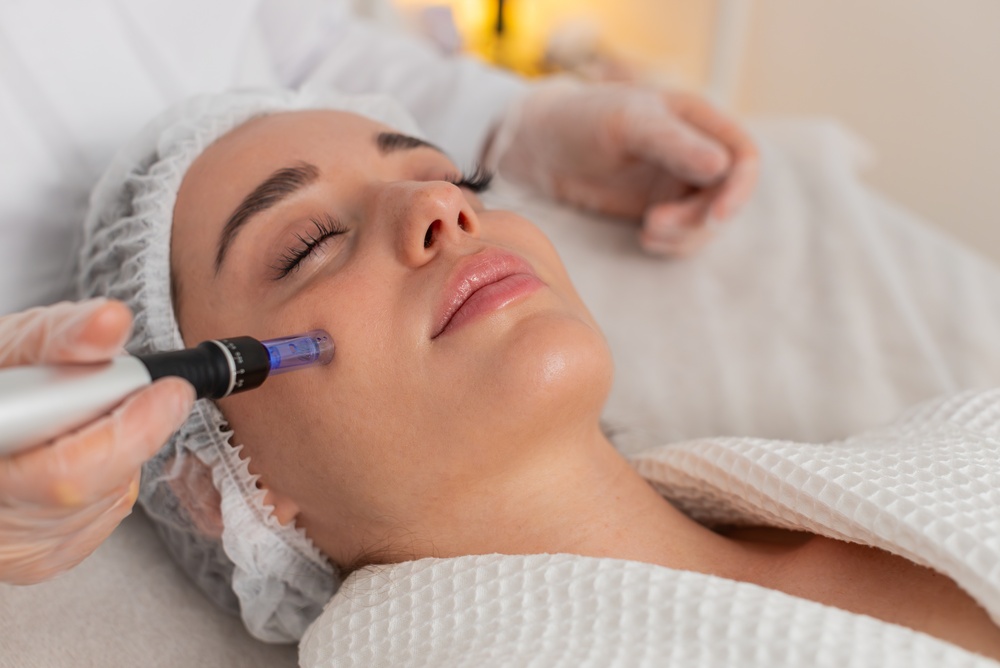 Skin Tightening vs. Microneedling in Tysons Corner, VA: Which Treatment Is Right for You?
