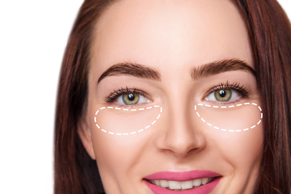 Under-Eye Filler Near Tysons Corner, VA: Cost, Results and What to Expect