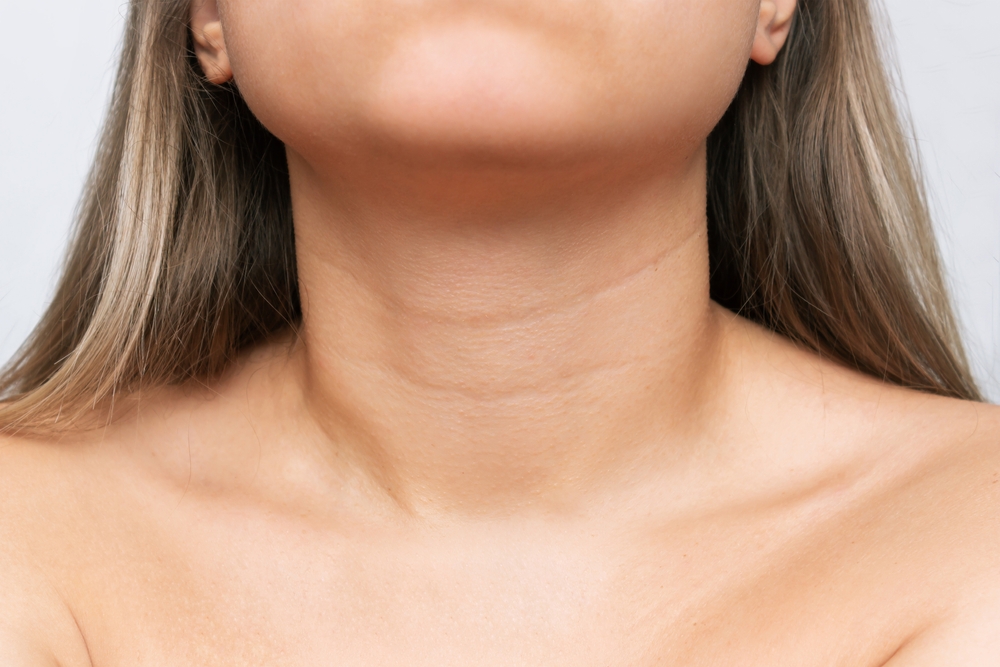Neck Filler / Sculptra Treatment for Tech Neck Lines in Vienna, VA
