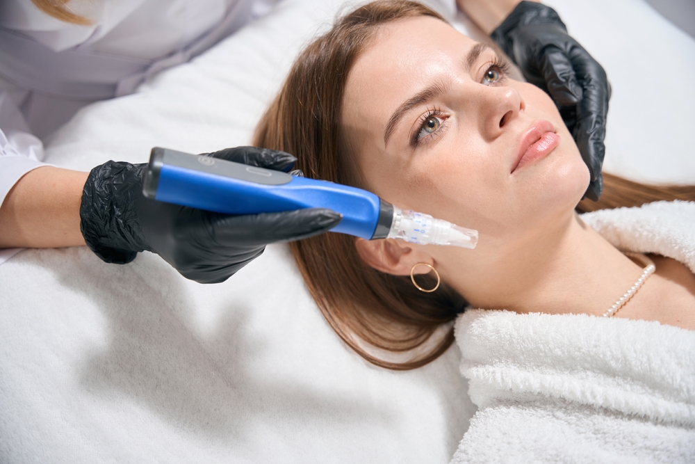 SkinPen Microneedling Vienna VA