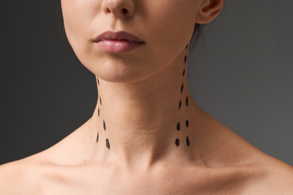 Nefertiti Neck Lift in Vienna and Tysons VA